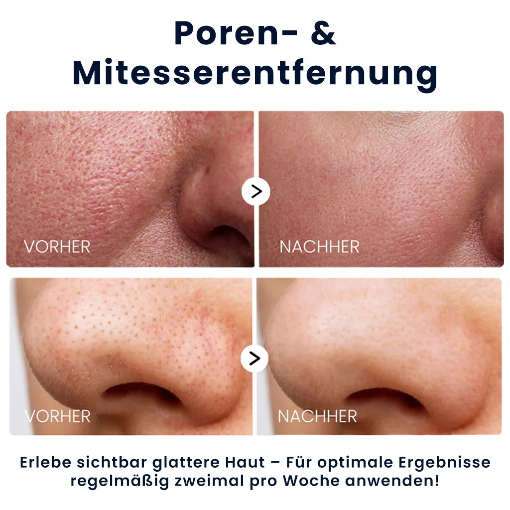 Dr. Melaxin™ Reis Peeling Serum