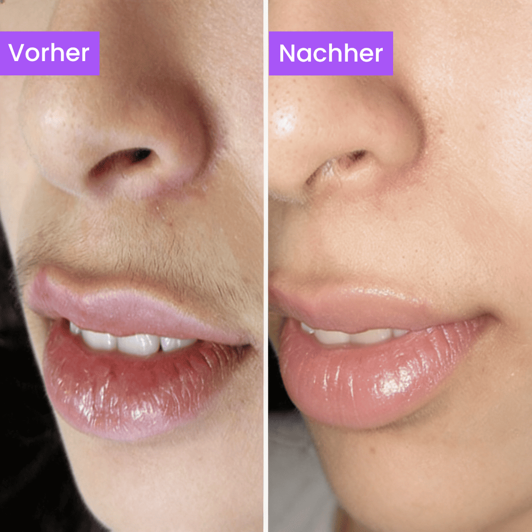 Anti-Haarwuchs Serum (Ägyptisches Geheimnis)