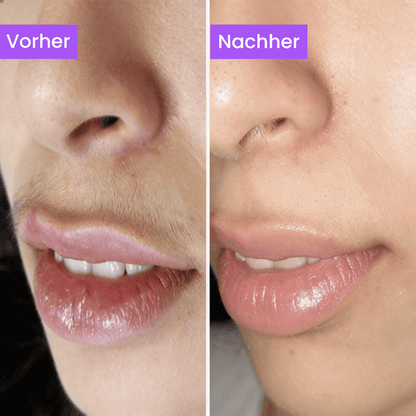 Anti-Haarwuchs Serum (Ägyptisches Geheimnis)