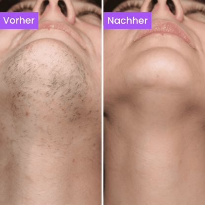 Anti-Haarwuchs Serum (Ägyptisches Geheimnis)