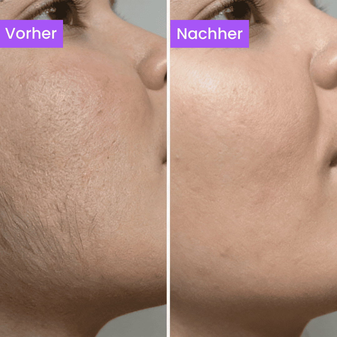 Anti-Haarwuchs Serum (Ägyptisches Geheimnis)