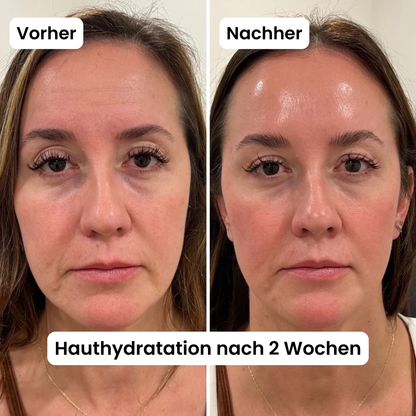 Poren-Reset-Serum (Reis Peeling)