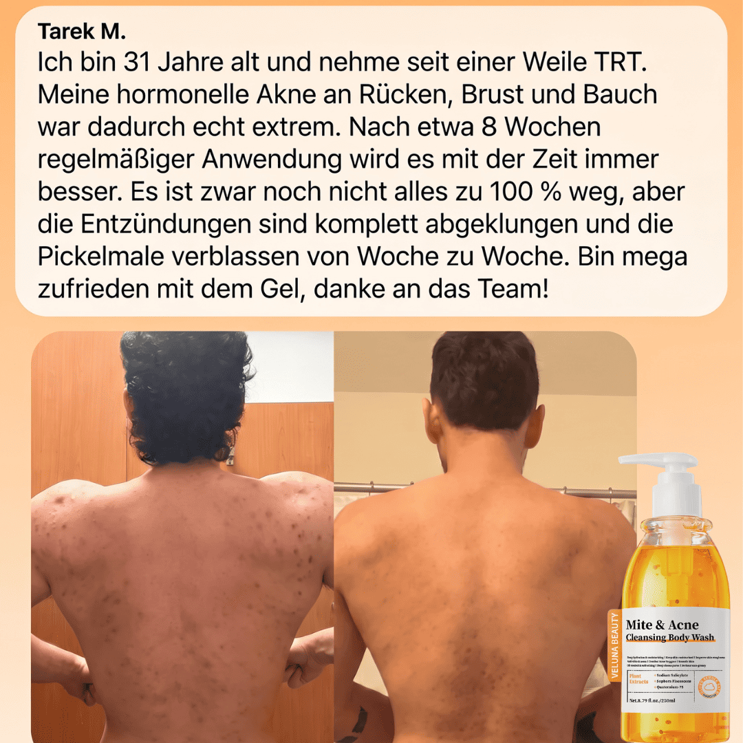 Veluna Akne Frei Body Wash