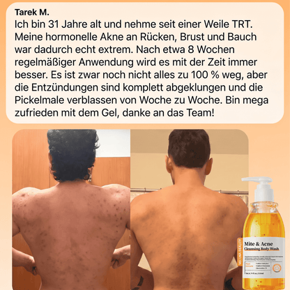 Veluna Akne Frei Body Wash
