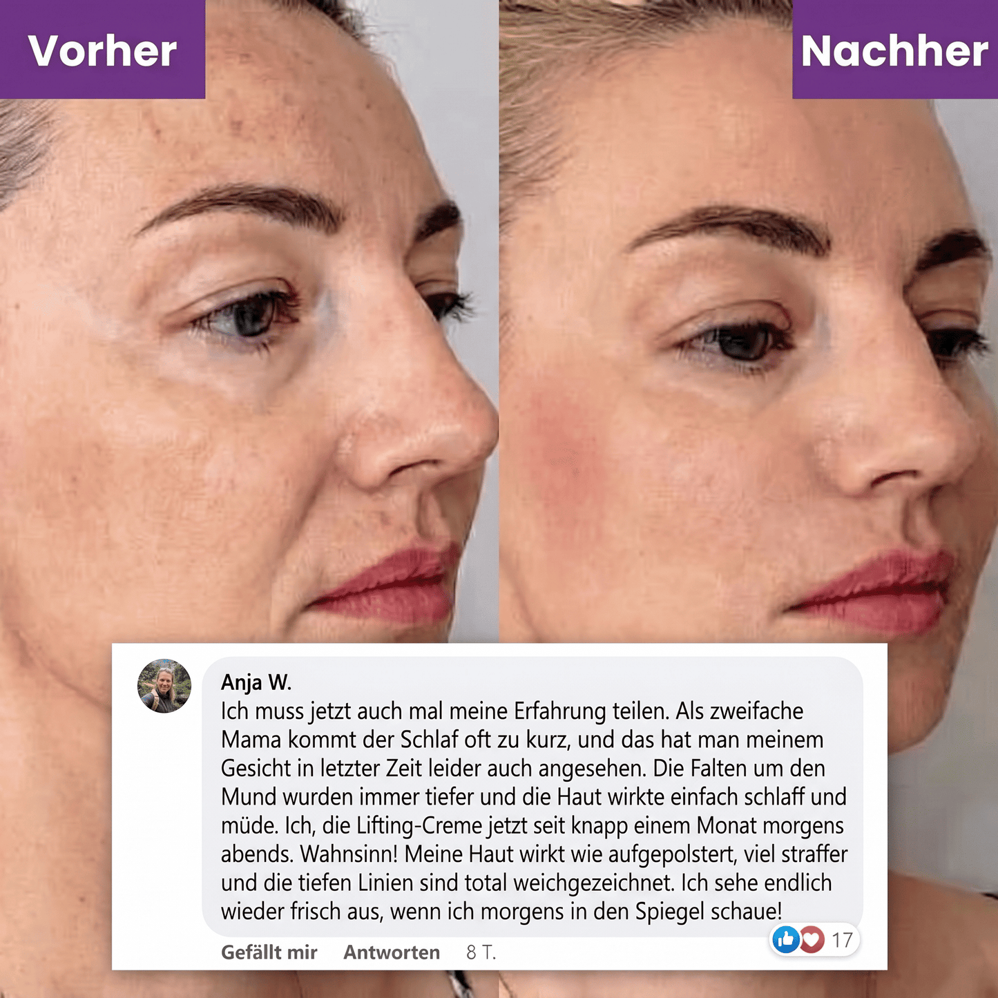 Veluna Lifting Creme (17-Peptide-Komplex)